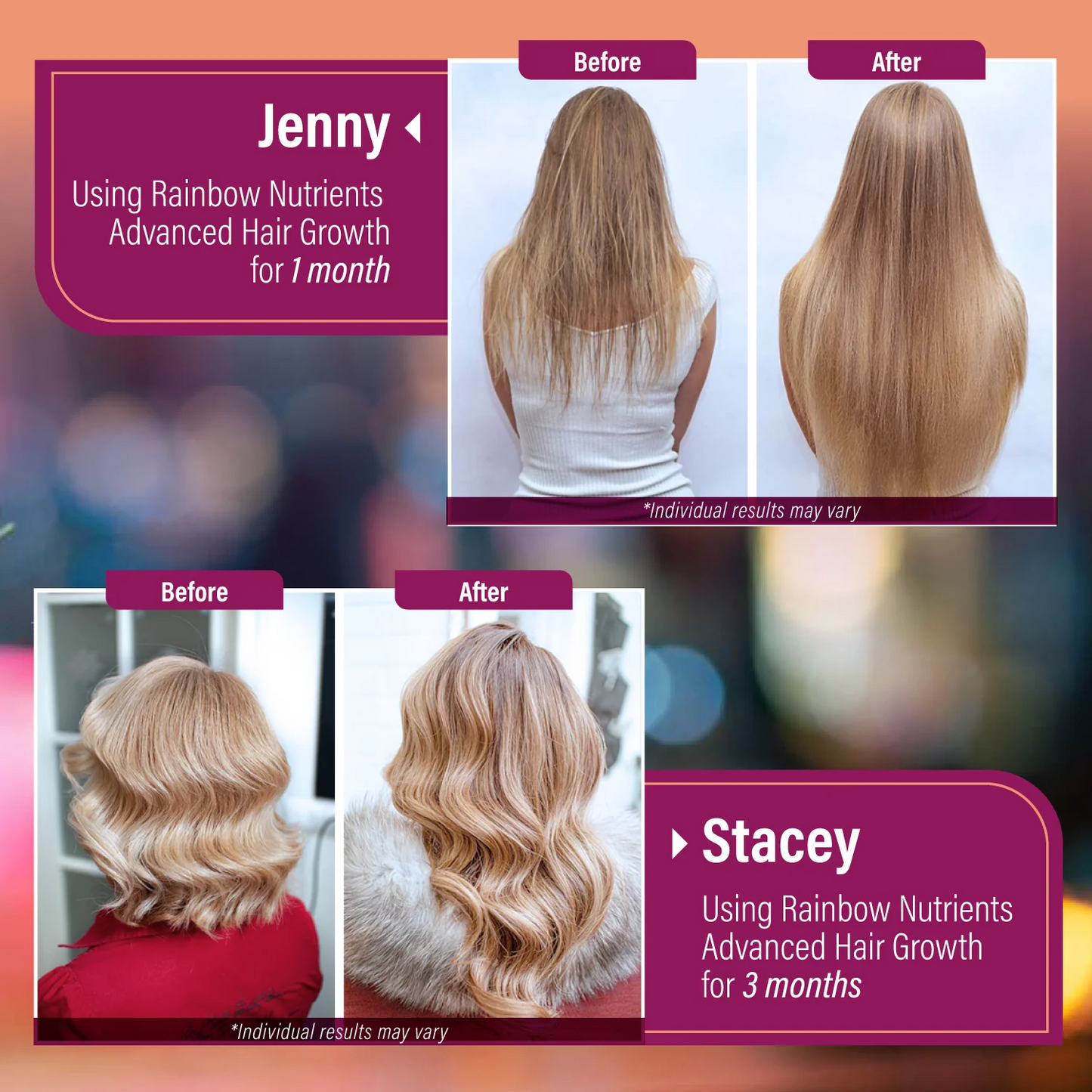 Advanced Hair Growth for Women